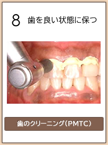 歯を良い状態に保つ（歯のクリーニング・PMTC）